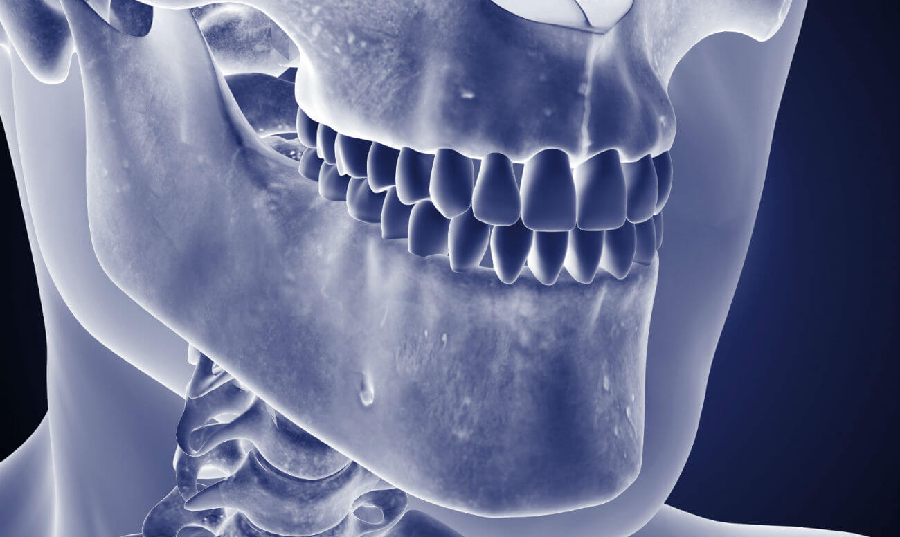 Остеомиелиты челюсти