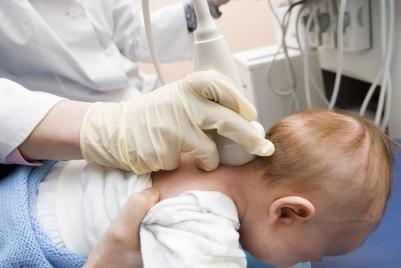 Церебральная ишемия у новорождённых - симптомы, причины, лечение