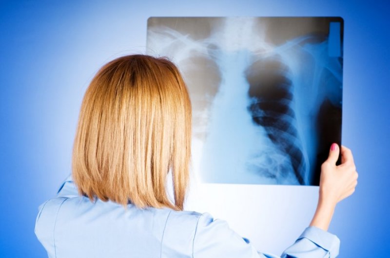рентгеновские снимки с пневмонией