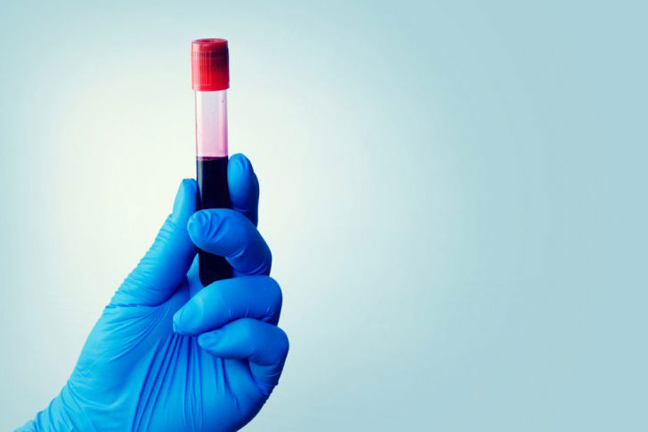 бактериологическое исследование крови