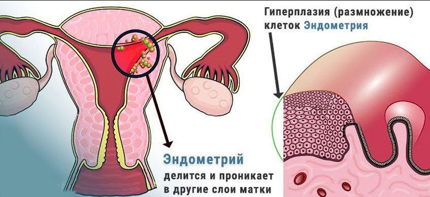 Нормы эндометрия по фазам