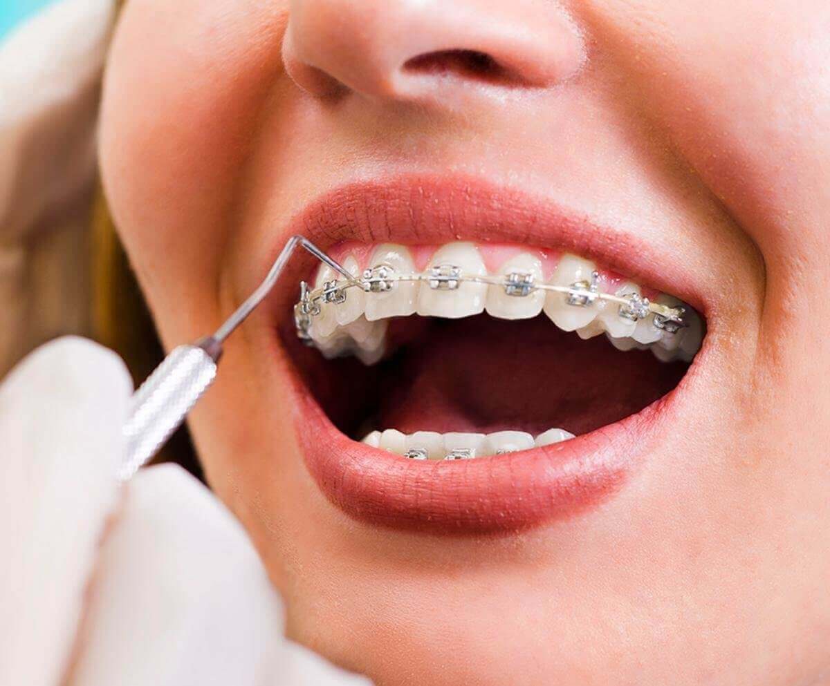 Что такое ортодонтия?